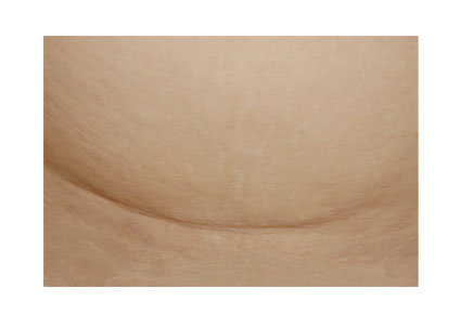 Ů���ʸ�����Ķ�Ƥ �Ҳ��̶�